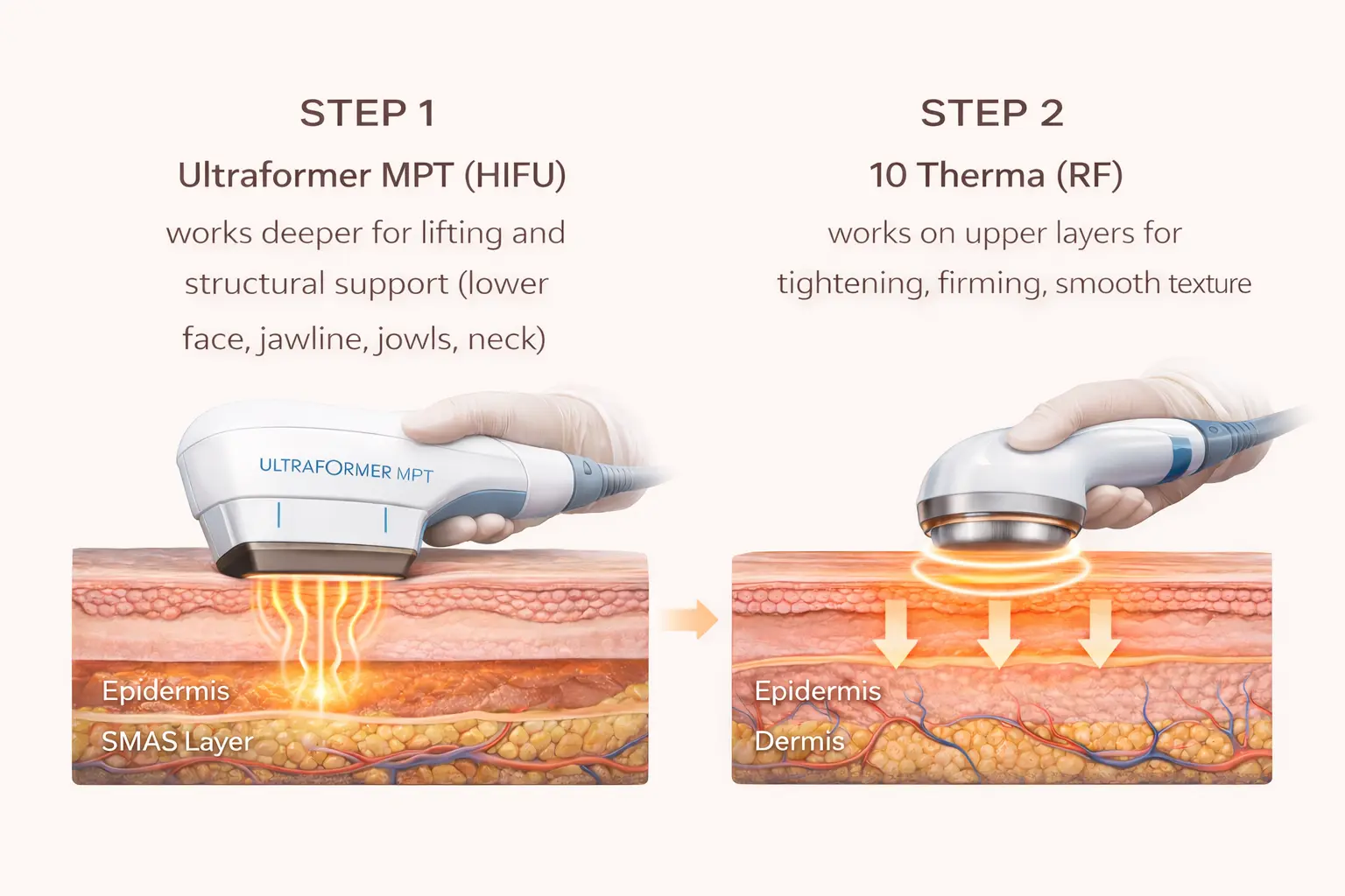 Two-step treatment process diagram